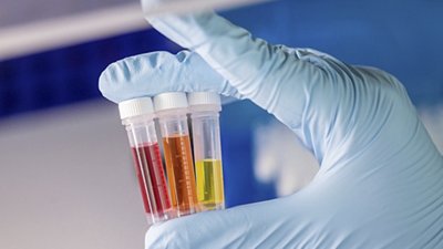 Blue gloved hand holds three vials of red, orange, and yellow liquid. 